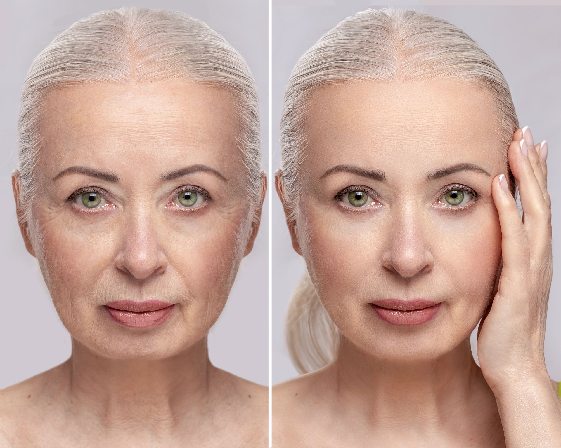 A before and after photo of an older woman 's face.