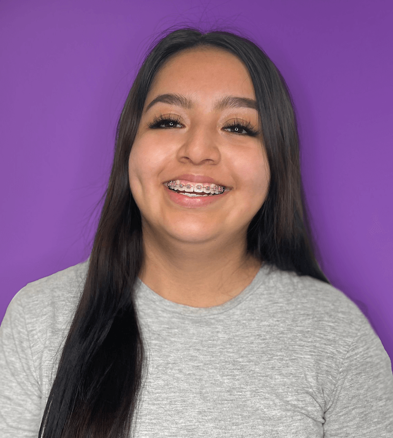 braces montebello smile patient