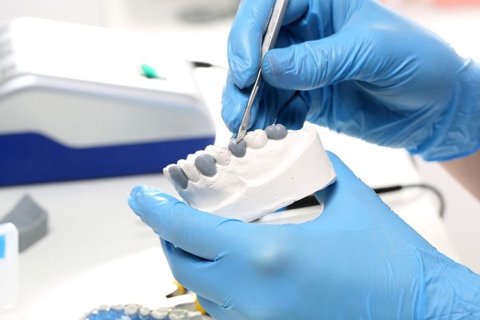 Protesi dentali fisse e mobili