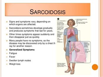 Global Indoor Health Network - Sarcoidosis caused by environmental exposures