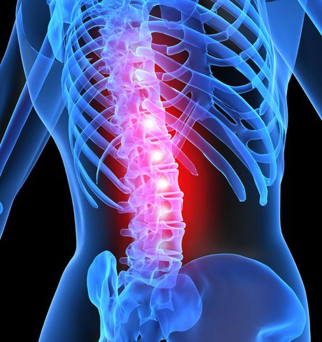 Chiropractor — Back Pain in New Bedford, MA