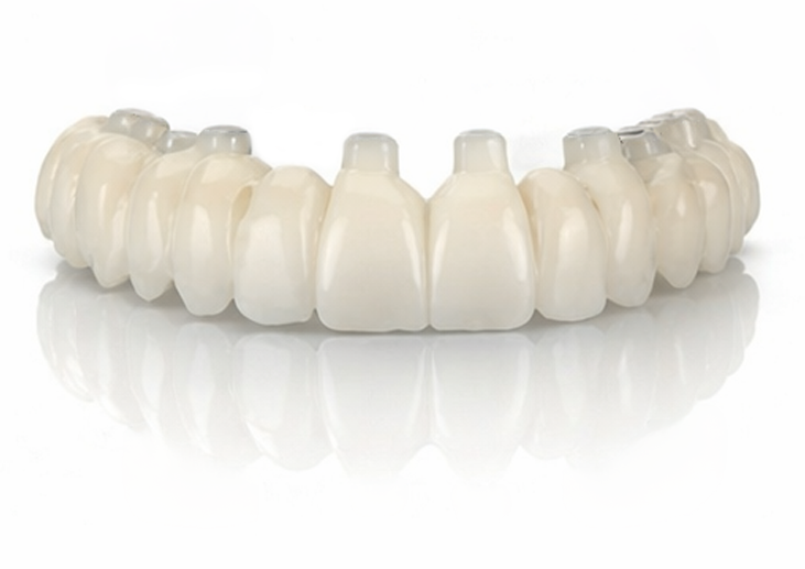 Dental implant bridge prosthetic teeth model