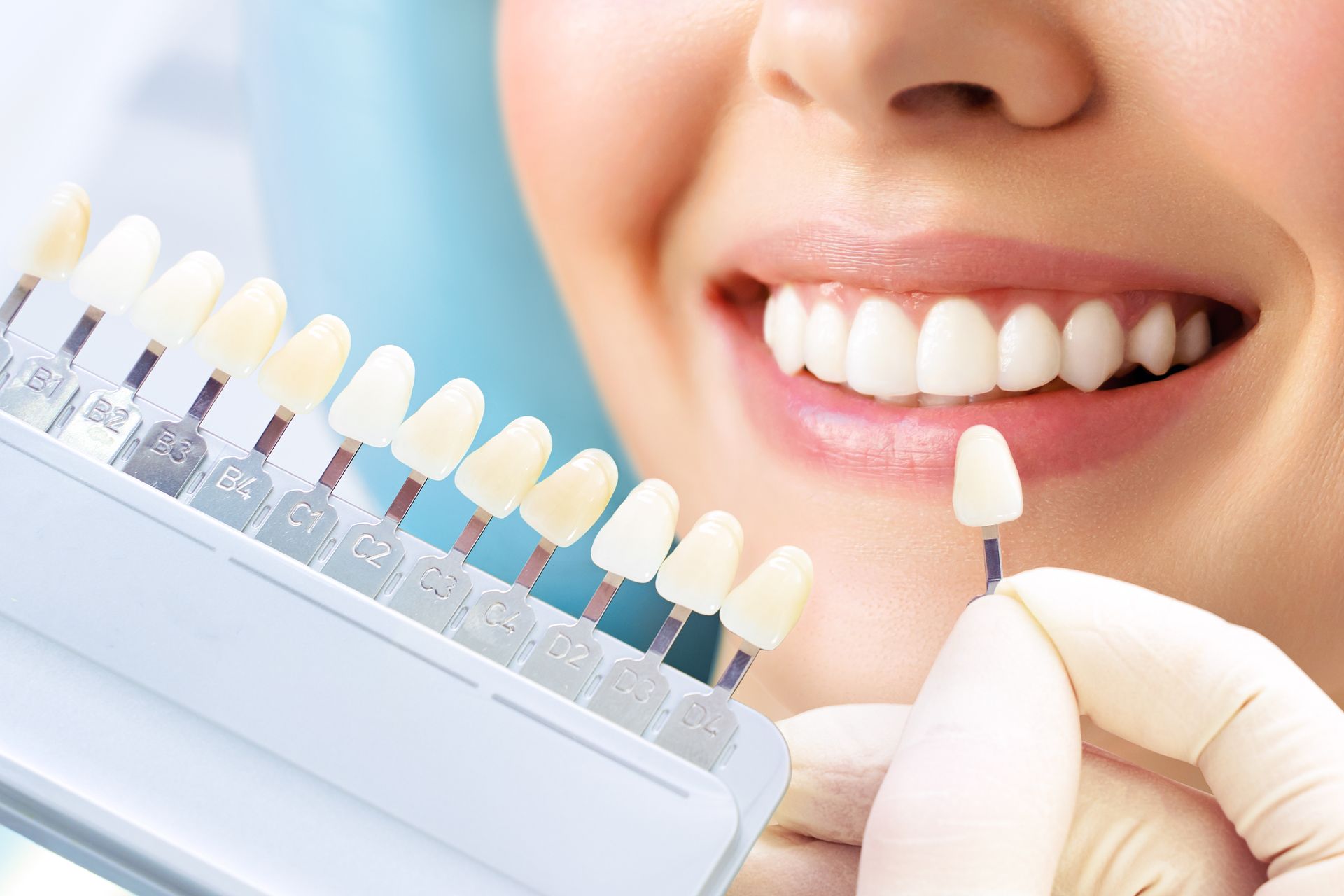 A teeth shade guide is being matched to the patient's smile for cosmetic dental treatment