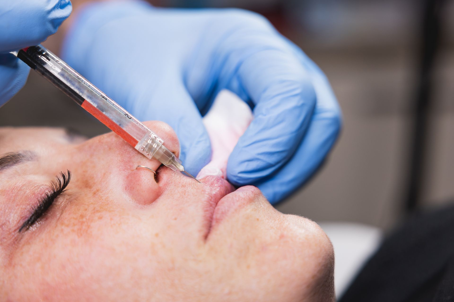 A professional is administering a cosmetic injection.
