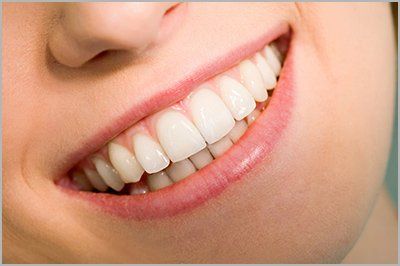 Smiling Woman with clean teeth  — Gum Disease in Glen Mills, PA