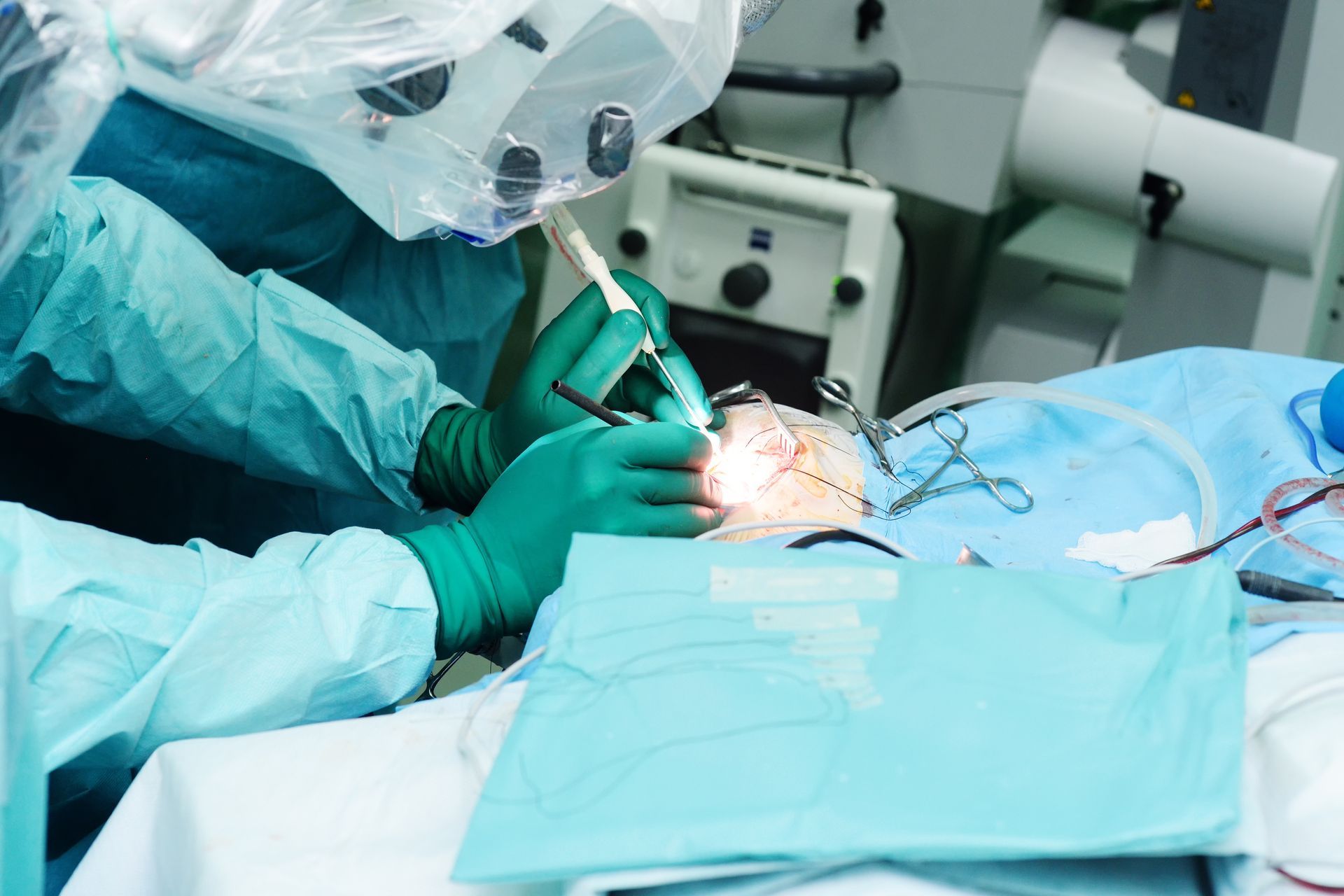 Quando se deve operar o meningioma Quando se deve operar o meningioma