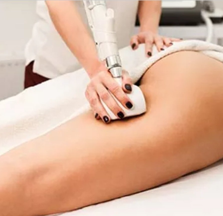 Sculpting Therapies — Winsted, MN — Lotus Body Sculpting