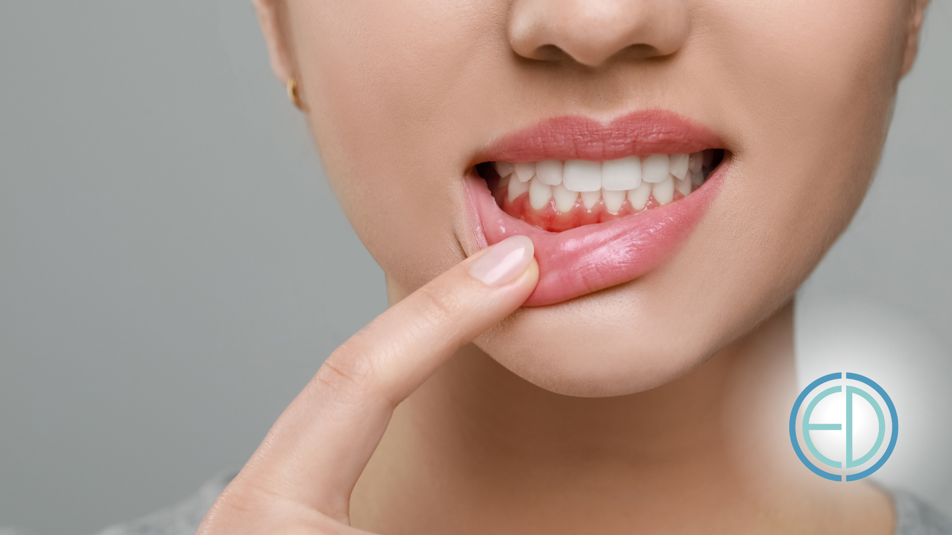 A woman is pointing at her teeth with her finger.