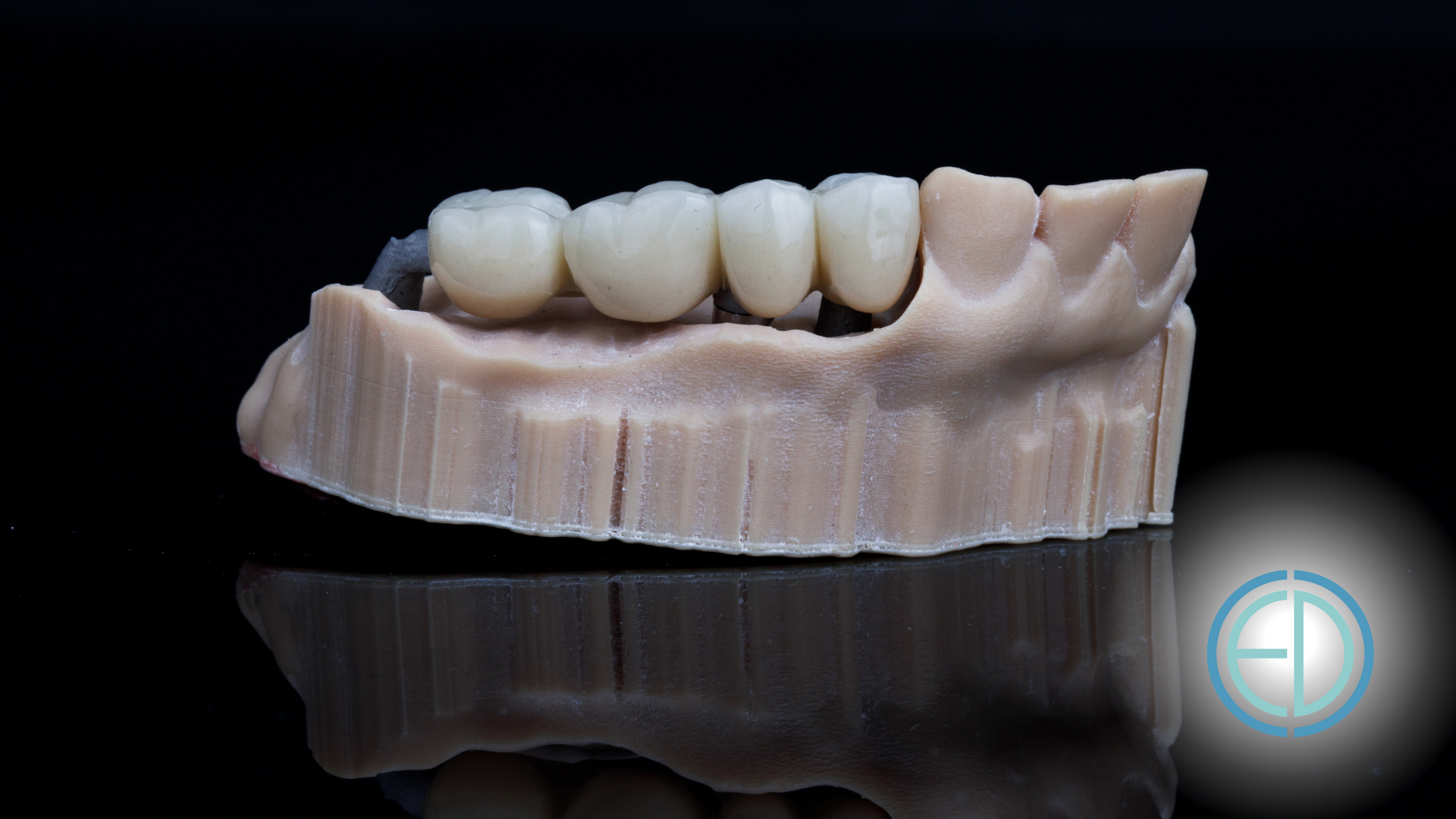 A model of a person 's teeth on a black background