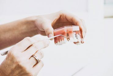 A dentist's hands demonstrate a dental implant model, pointing to a metal post set in the gums with a dental tool.