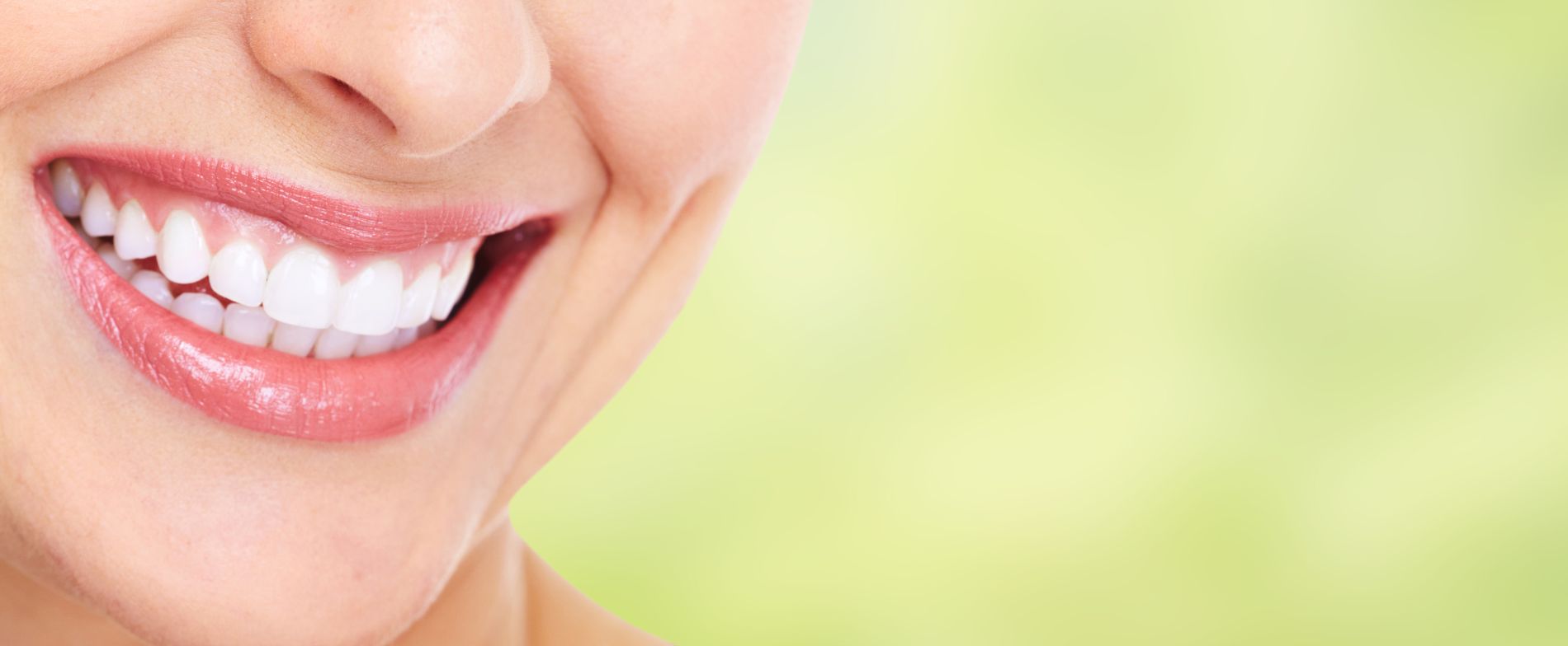 denti dopo pulizia professionale