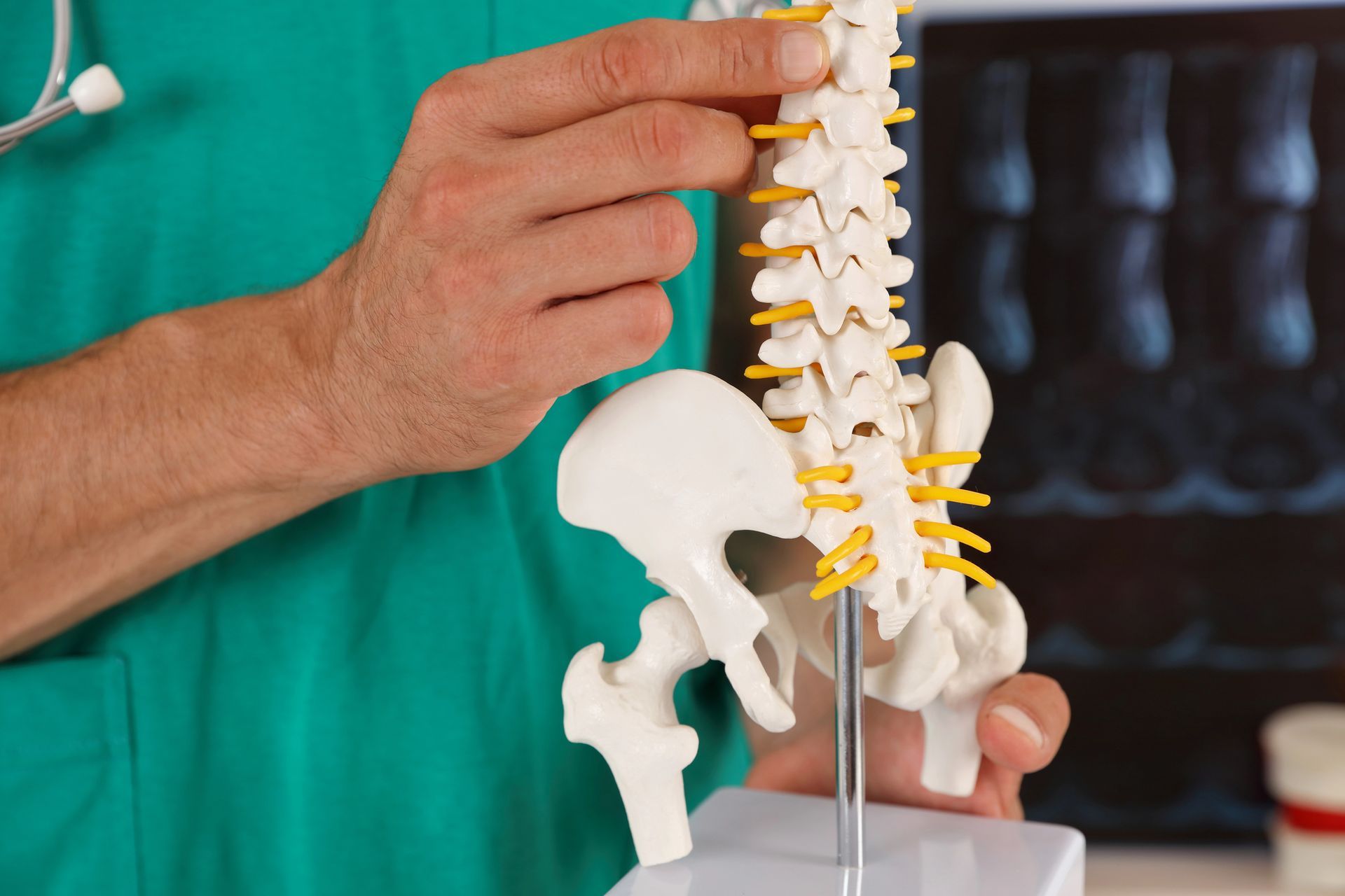 Doctor holding a spine model, pointing to it, with an X-ray in the background.