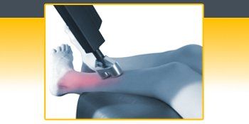Ankle Sprain — Sarasota, FL — Meilus Precision Therapy