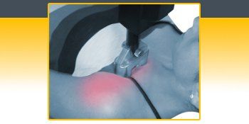 Shoulder Impingement — Sarasota, FL — Meilus Precision Therapy