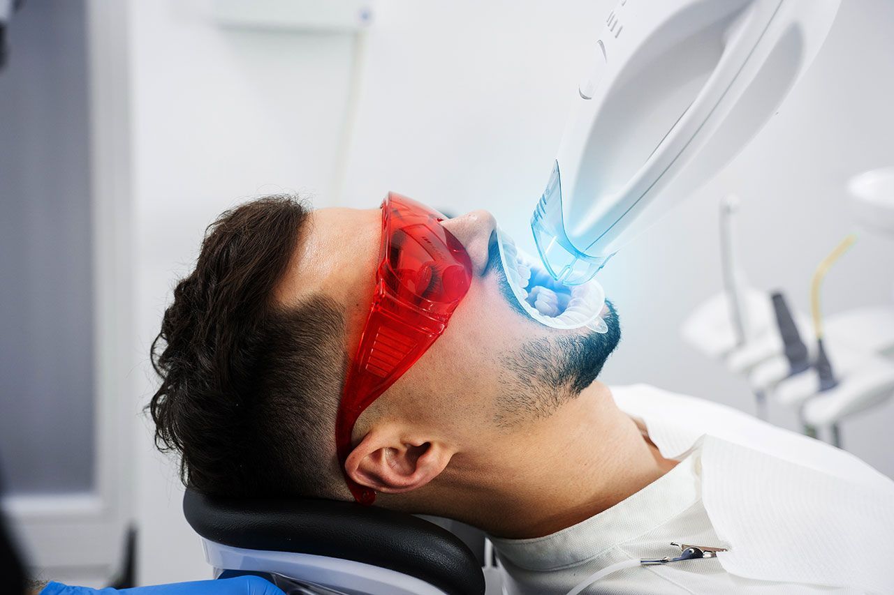 Teeth Whiteing