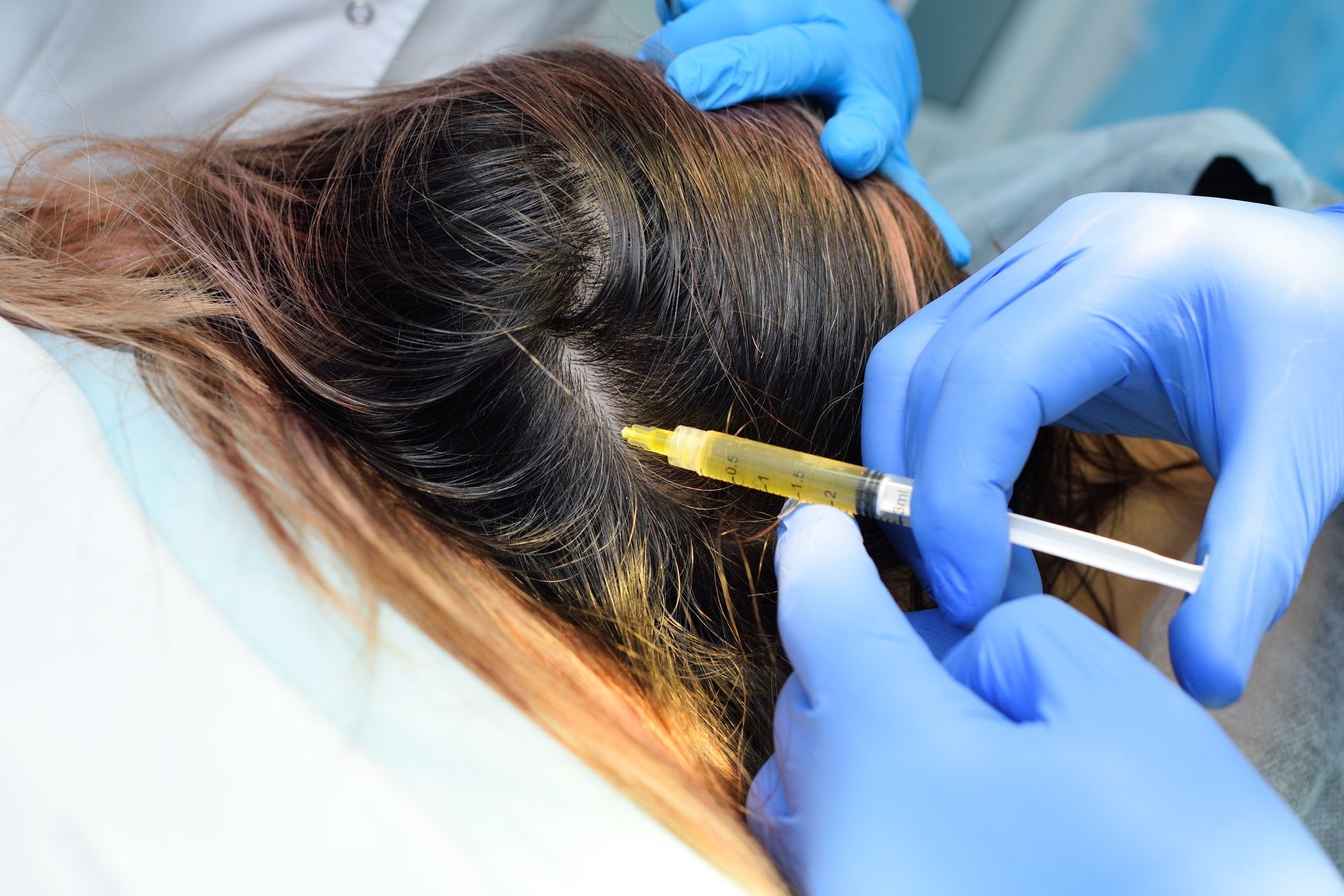 Une femme reçoit une injection dans ses cheveux