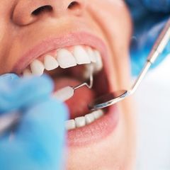 Dental Work — Oral Checkup At The Dentist in Merrillville, IN