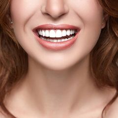 Dental Care — Healthy White Smile Close Up in Merrillville, IN