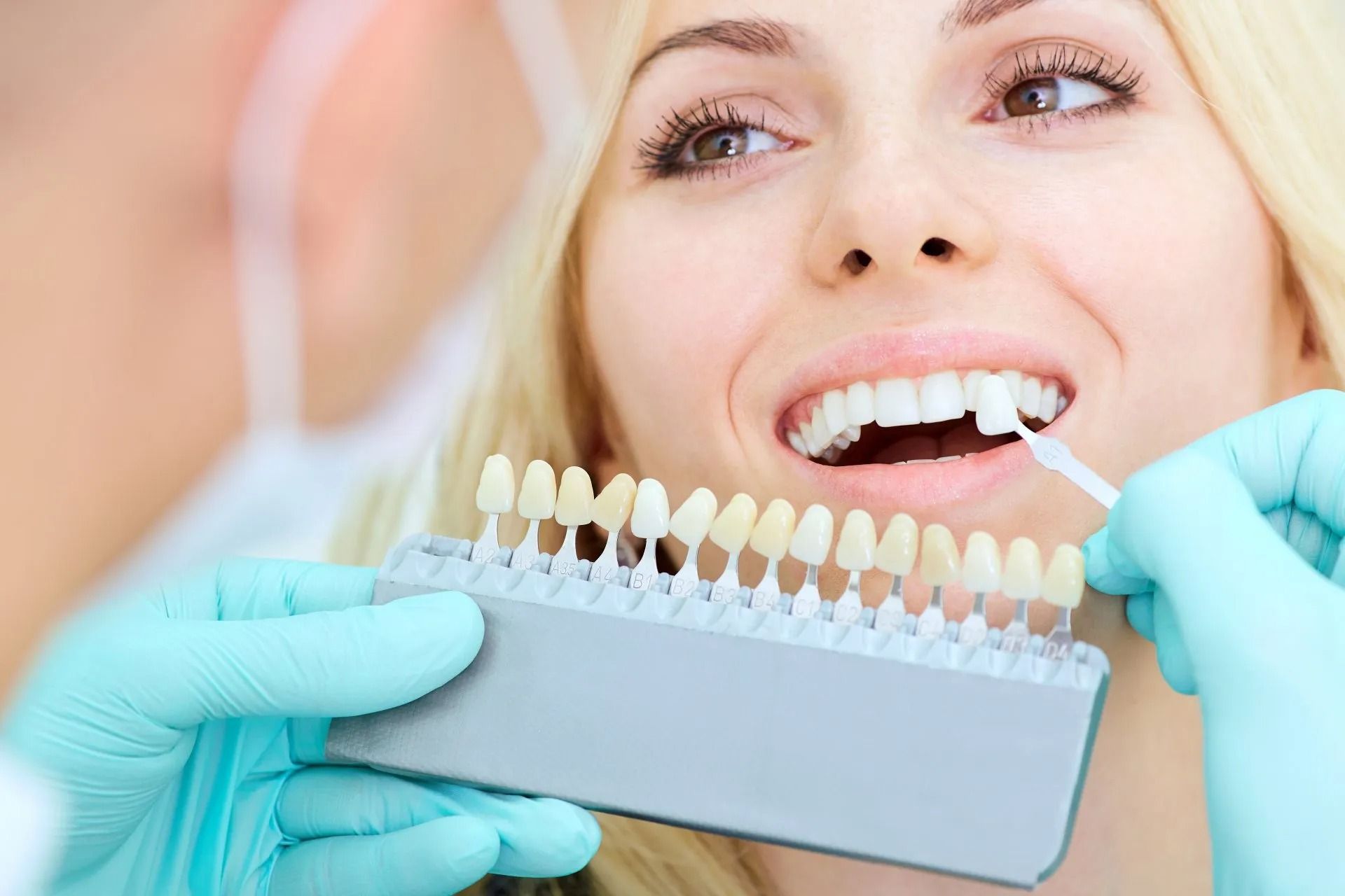 Dental shade matching for a smiling patient with gloved hands and tooth color guide