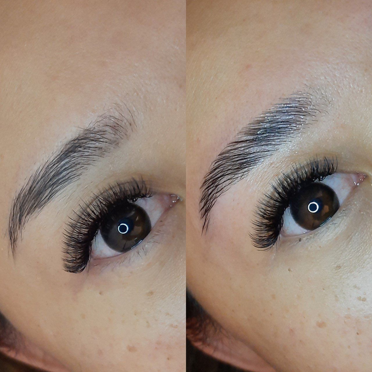 brow lifting heemstede