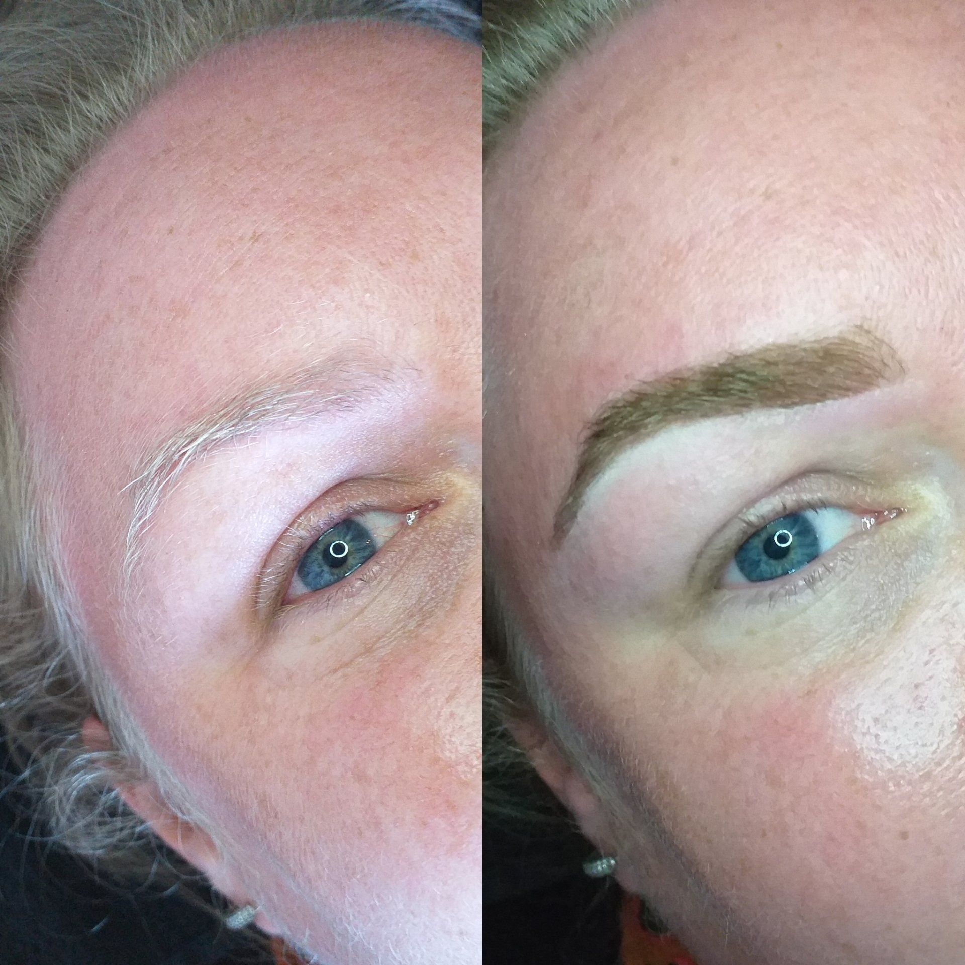 Brow shaping