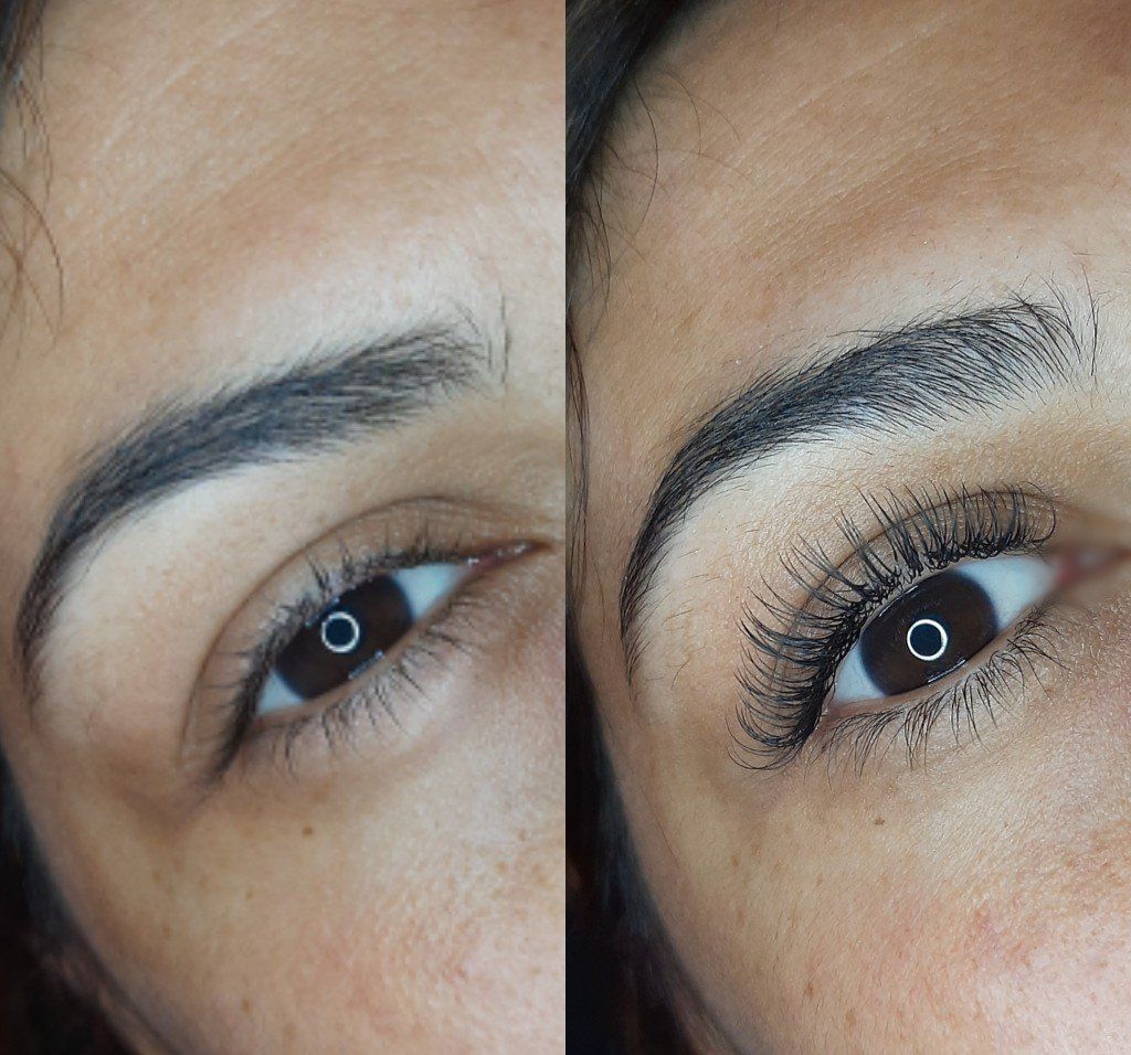 One by one extensions