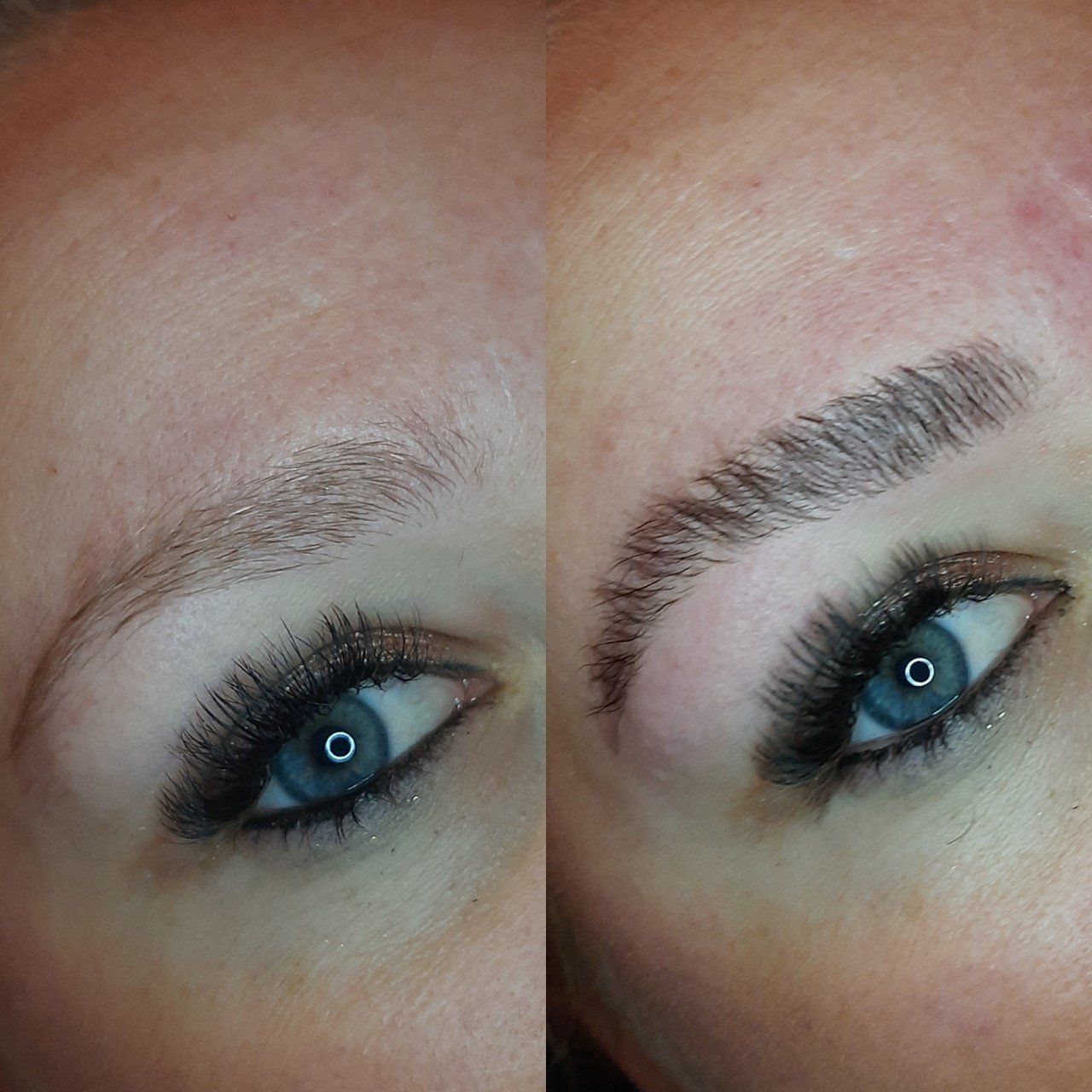 wenkbrauwlift schalkwijk