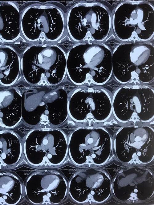RADIOLOGÍA E IMAGEN LIZARRAGA SC-Resonancia magnética