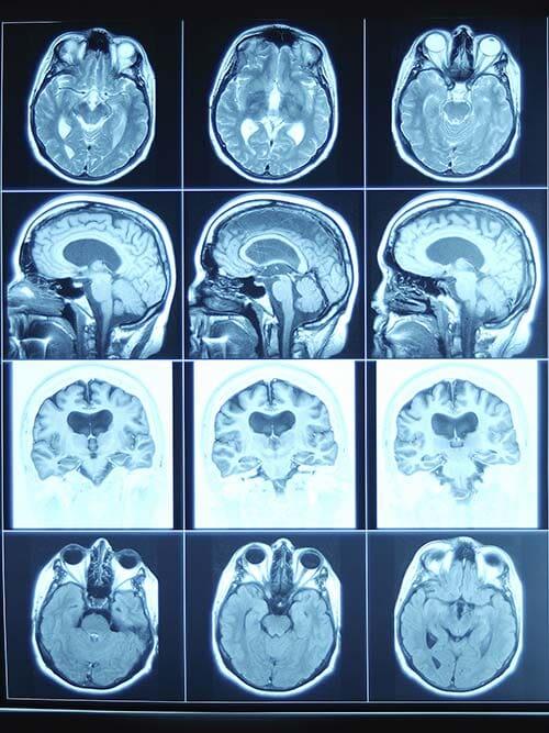 RADIOLOGÍA E IMAGEN LIZARRAGA SC - Resonancia magnética