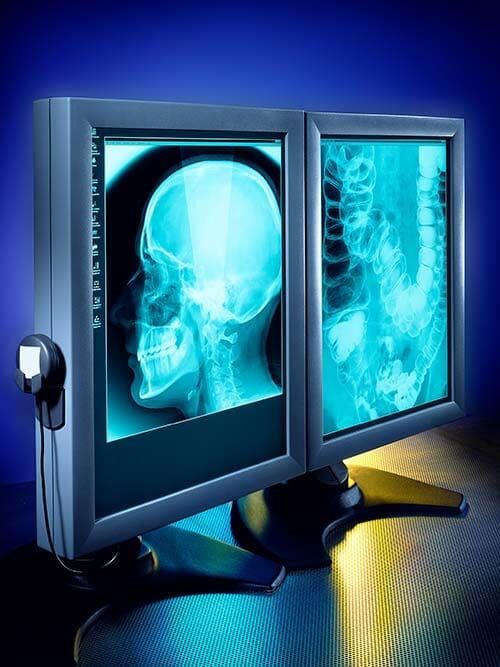 RADIOLOGÍA E IMAGEN LIZARRAGA SC - Servicios de rayos X, tomografía