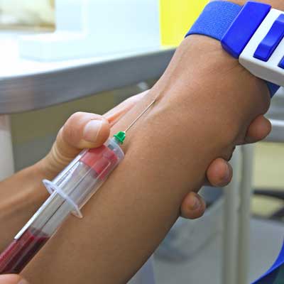 RADIOLOGÍA E IMAGEN LIZARRAGA SC - química sanguínea