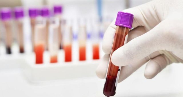 psicologiasdobrasil.com.br - Médico alerta: exame de sangue simples prevê infarto em qualquer pessoa — e quase ninguém sabe disso