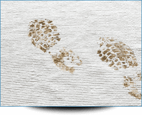 Dirty footprints and stains on a rug in Keynsham.