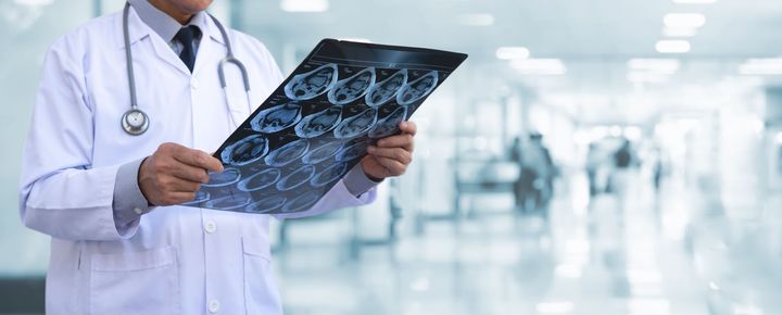 Doctor reviewing brain scan images in a modern hospital medical facility.