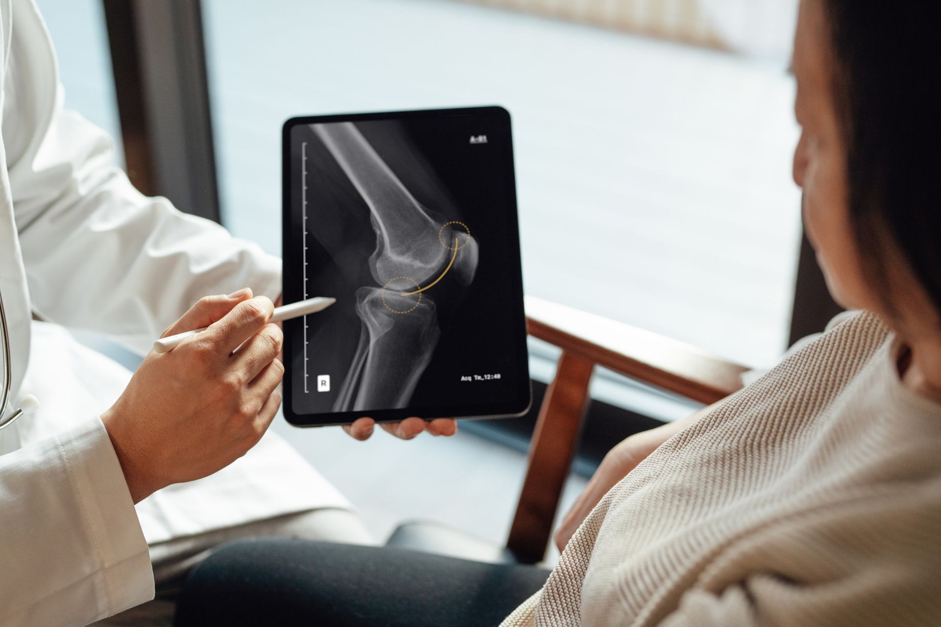 A doctor is holding a tablet with an x-ray of a knee on it.
