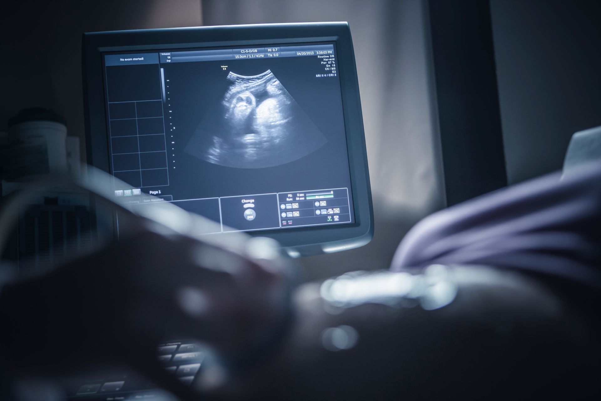 A person is looking at an ultrasound of a baby on a computer screen.