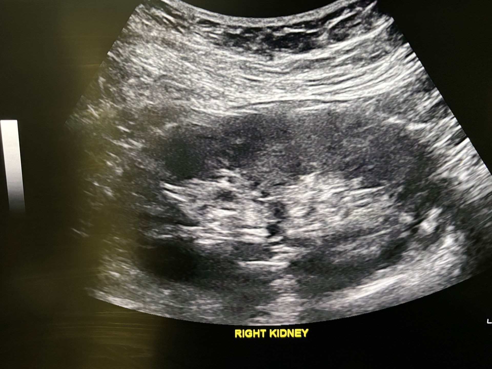 A person is using an ultrasound machine in a hospital room.