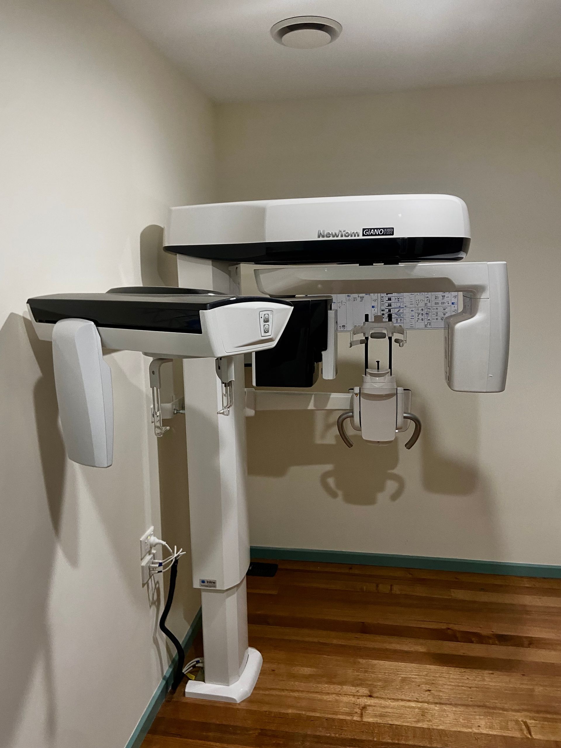 Two x-rays of a human skull on a black background.