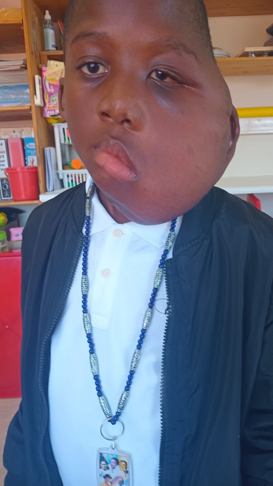 Alondwe recovering back at home after tumor surgery