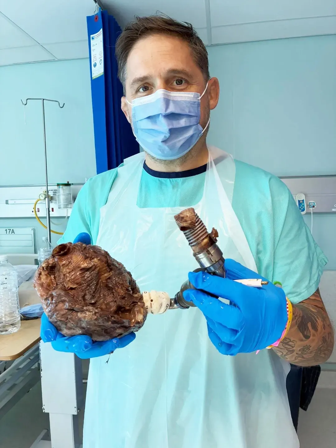 Rhys Thomas, 43, holds his damaged heart in his hands following his heart transplant at Netcare Christiaan Barnard Memorial Hospital in Cape Town. Rhys Thomas, 43, holds his damaged heart in his hands following his heart transplant at Netcare Christiaan Barnard Memorial Hospital in Cape Town.