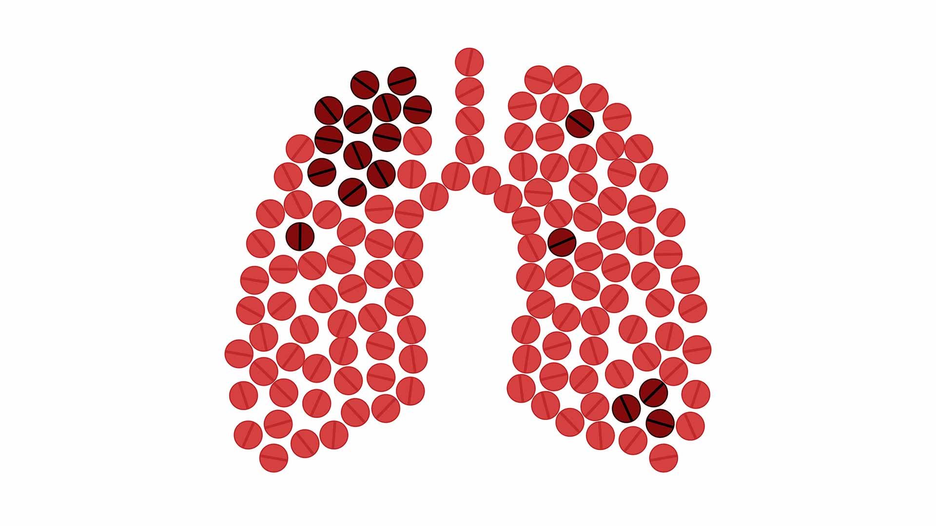 Do not let C-19 derail TB testing and treatment