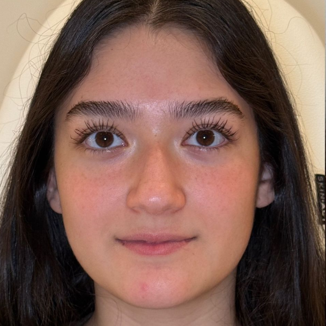 Skin before treatment