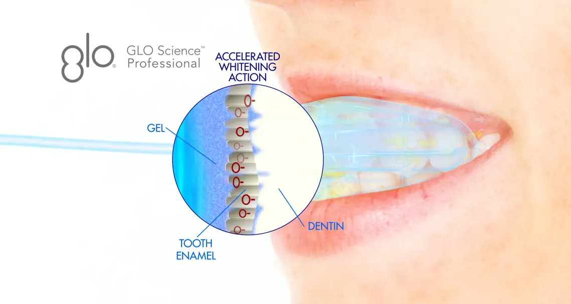GLO Science Professional Teeth Whitening Device Animation