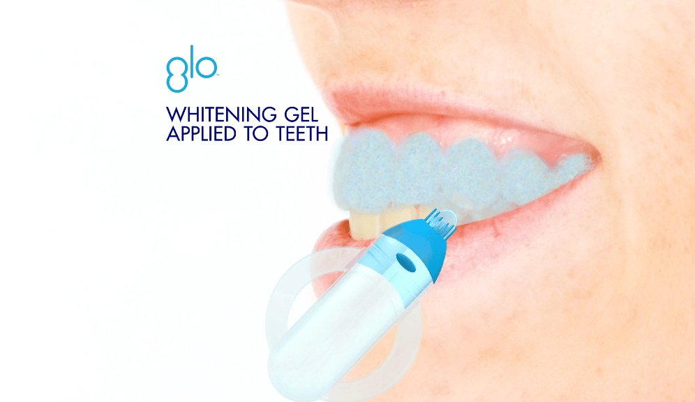 GLO Science Teeth Whitening Device Animation