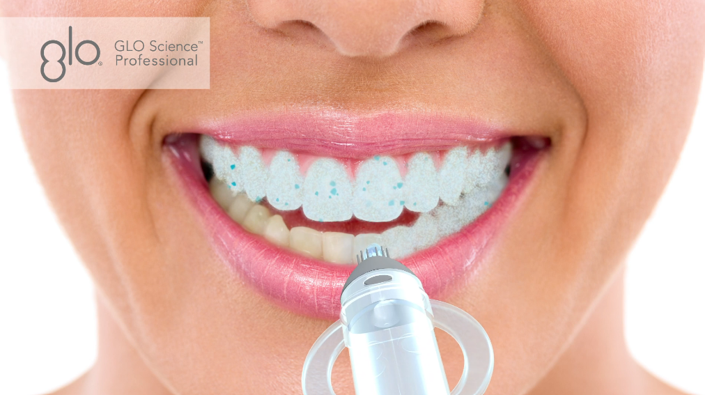 Professional Strength Teeth Whitening GLO Vials