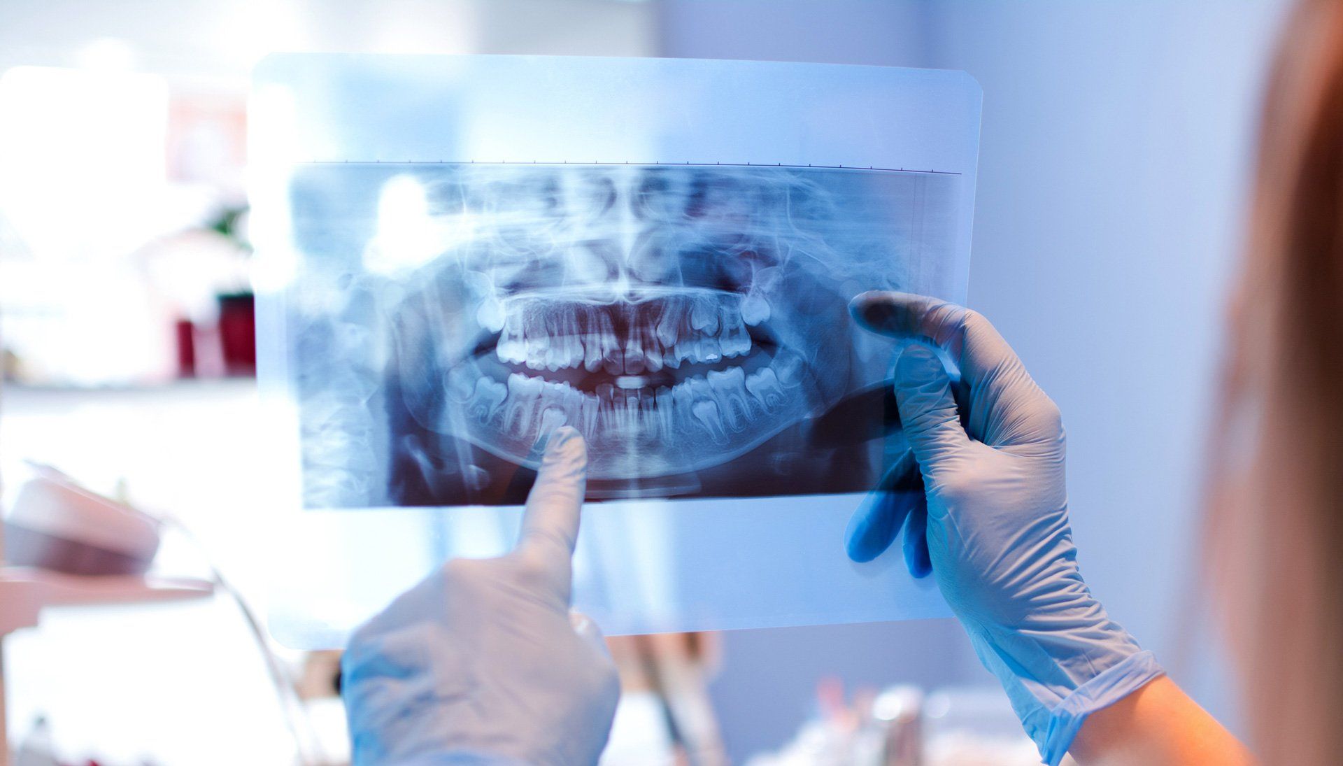 Dentist X-ray Result — Pensacola, FL — Dr. Phillip Drlicka, D.D.S.