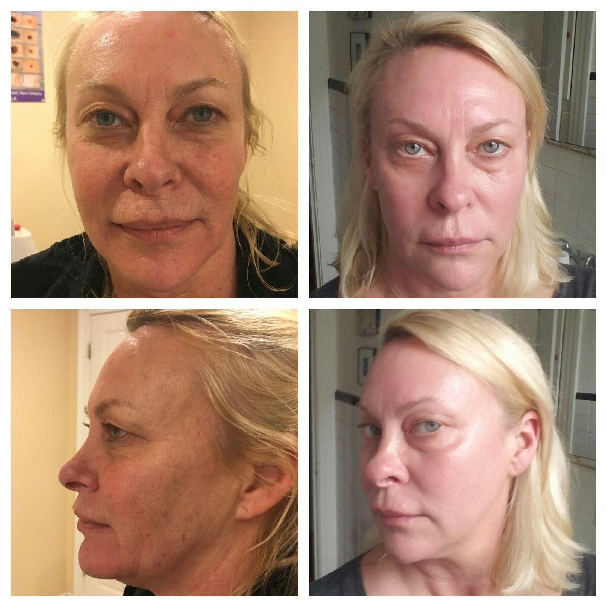 A collage of four pictures of a woman 's face