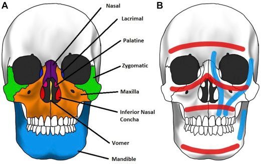 Sunrise Hospital. Patient with facial fracture received no medical care and no food or hydration.