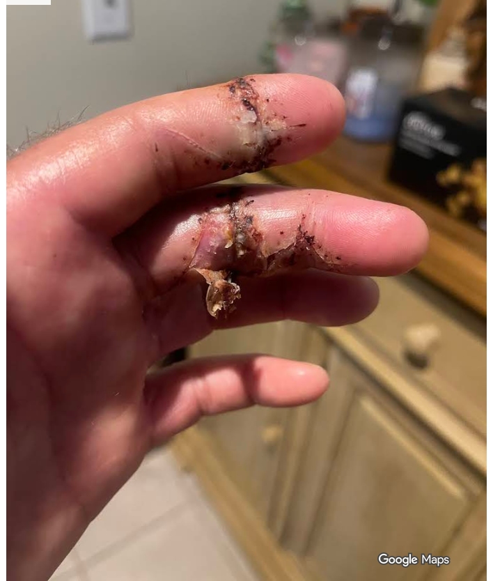 Sunrise Hospital. Patient-106 had an unsuccessful surgery by Dr. Kevin Golshani at Nevada Orthopedic.