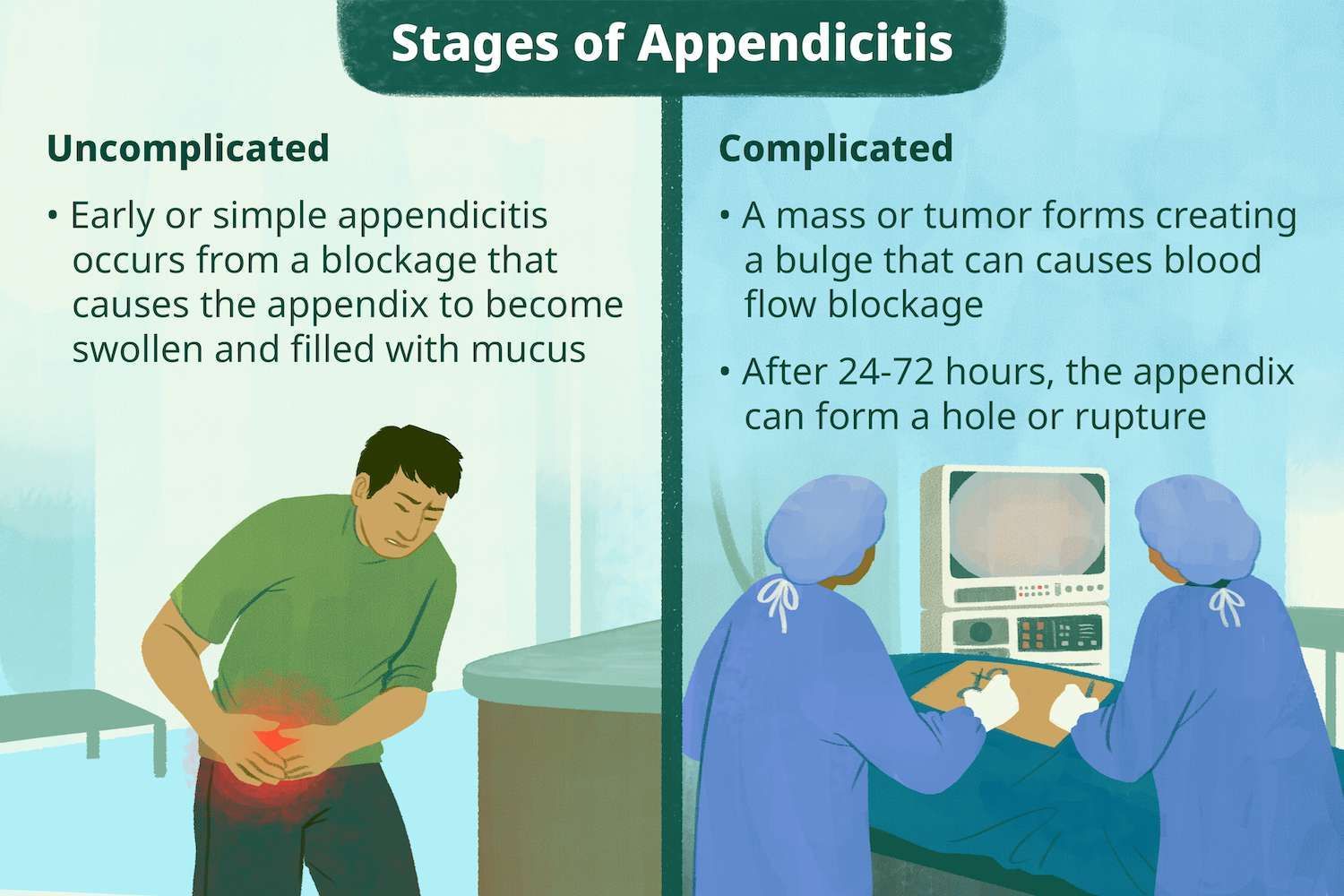 Sunrise Hospital. Patient-130, stages of appendicitis